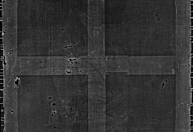 Radiographie / ©Arcanes