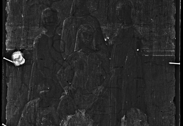 Radiographie  / ©Arcanes